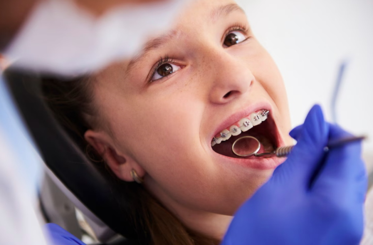 5 Teeth Issues That Metal Braces In Surrey Can Help Correct 5 Teeth Issues That Metal Braces In Surrey Can Help Correct